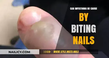 The Hidden Dangers of Nail Biting: Can It Lead to Infections?