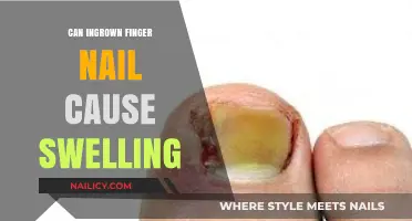 Understanding Ingrown Fingernails: Causes, Symptoms, and Effective Treatments