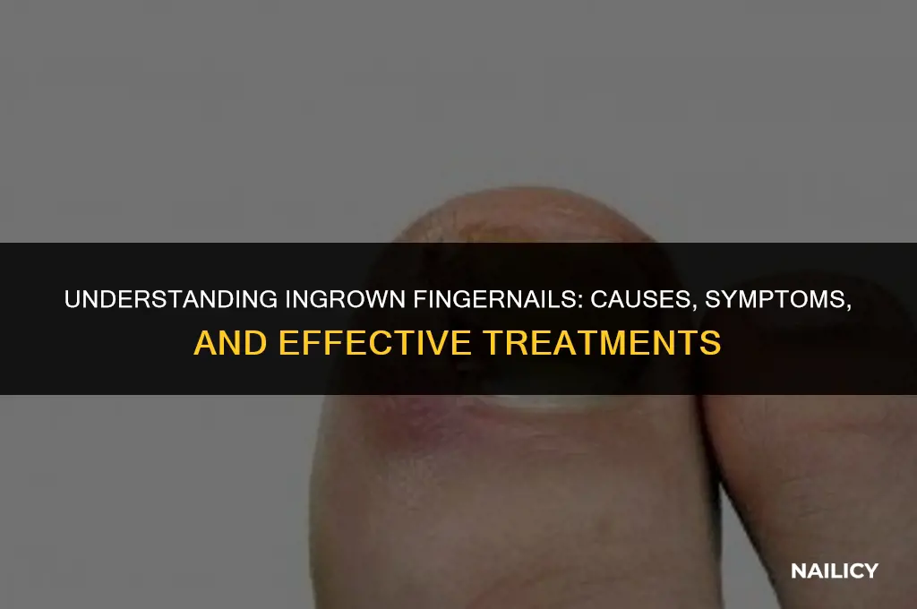 can ingrown finger nail cause swelling
