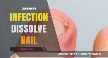 Can Ingrown Infections Dissolve Your Nail? Facts and Remedies