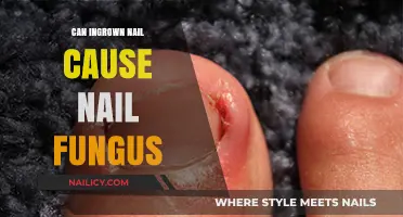 Exploring the Link: Can Ingrown Nails Lead to Nail Fungus?