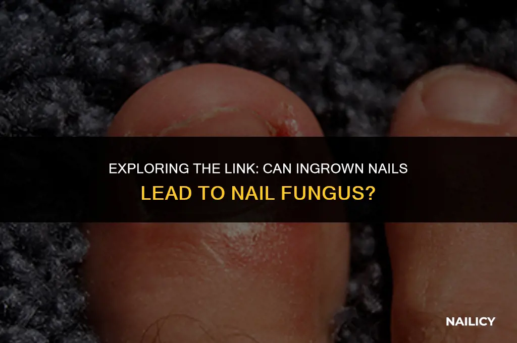 can ingrown nail cause nail fungus
