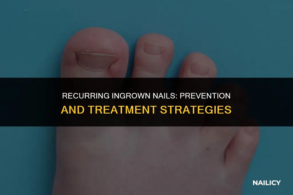 can ingrown nail happen again
