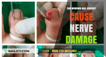 Exploring the Risks: Can Ingrown Nail Surgery Lead to Nerve Damage?