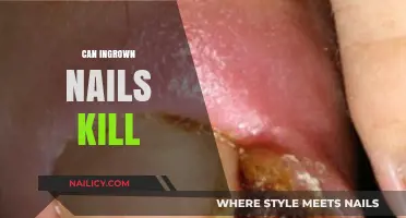 The Hidden Danger of Ingrown Nails: Can They Be Fatal?