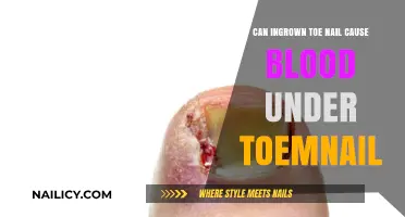 Can Ingrown Toenails Lead to Blood Under the Toenail?