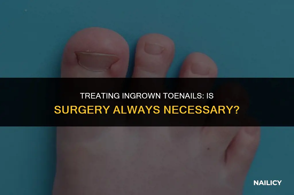 can ingrown toe nails be taken without the shots