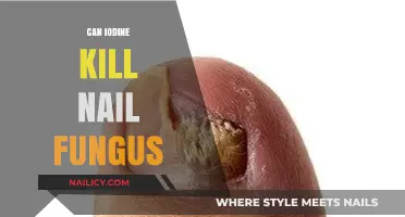 Iodine's Potential in Combating Nail Fungus: A Comprehensive Guide