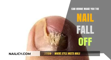 Iodine's Impact: Can It Cause Toenail Loss?