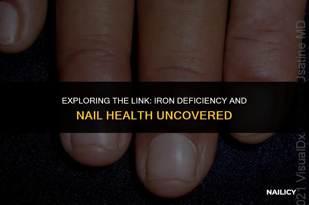 can iron deficiency affect nails