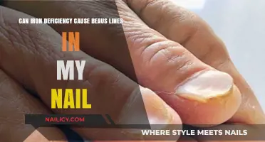 Exploring the Link Between Iron Deficiency and Beau's Lines in Nails