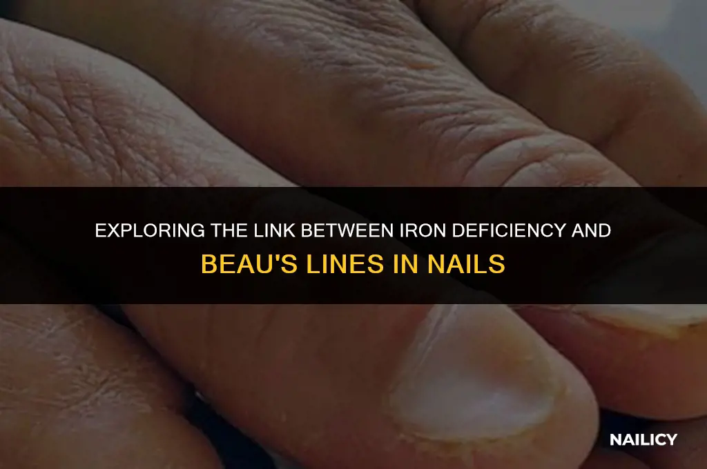 can iron deficiency cause beaus lines in my nail