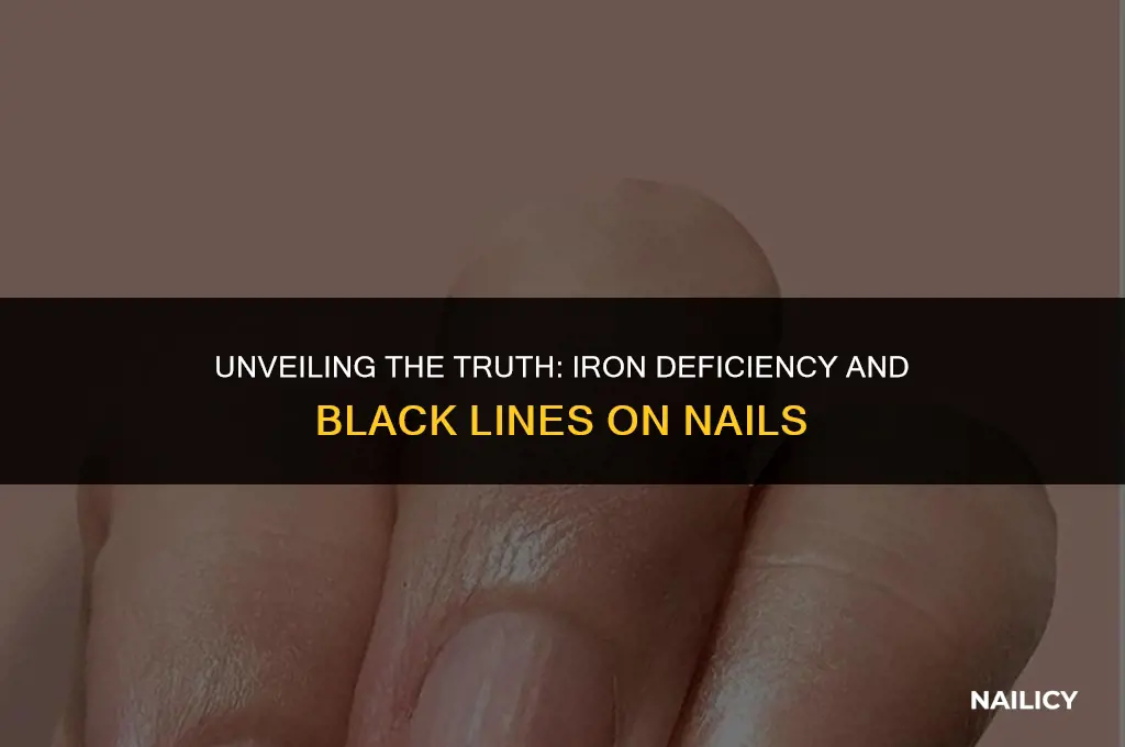 can iron deficiency cause black lines on nails