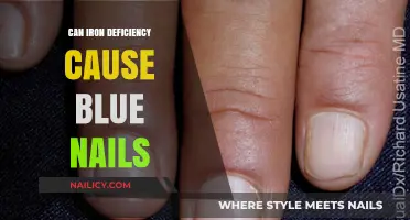Unveiling the Truth: Iron Deficiency and Its Impact on Nail Health