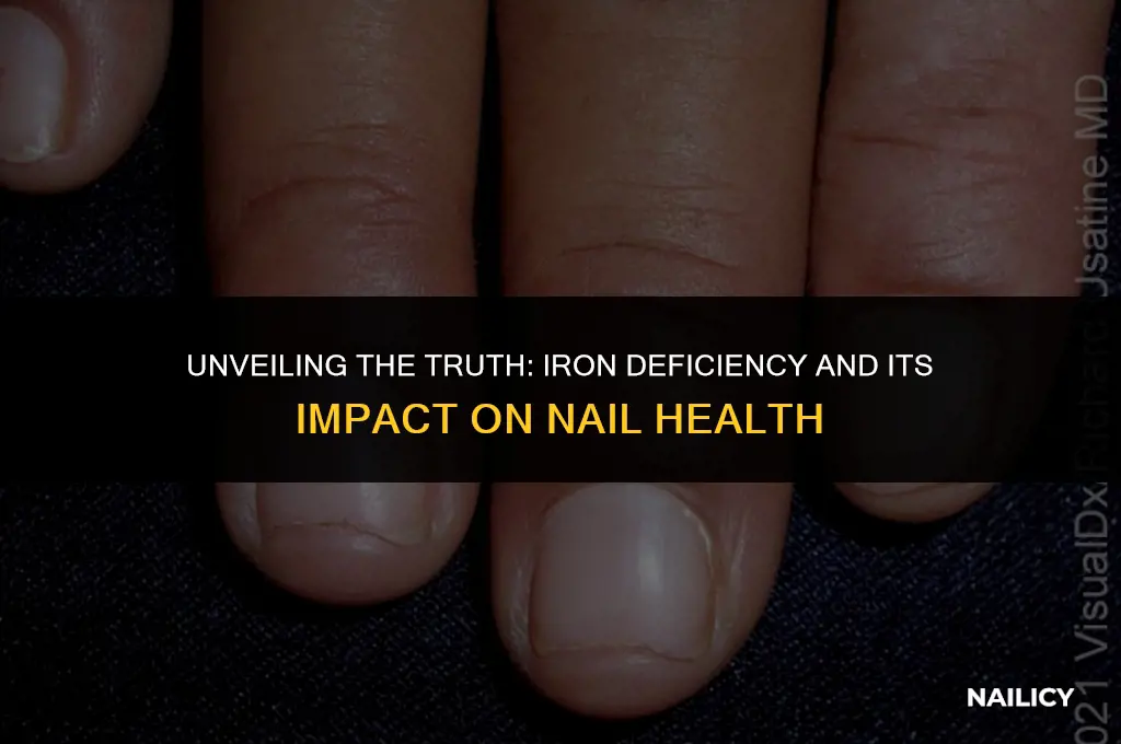 can iron deficiency cause blue nails