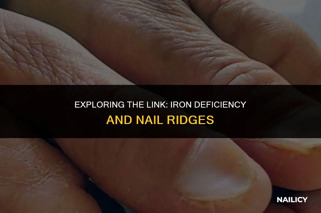 can iron deficiency cause nail ridges