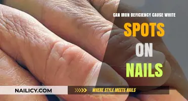 Unveiling the Truth: Iron Deficiency and White Spots on Nails
