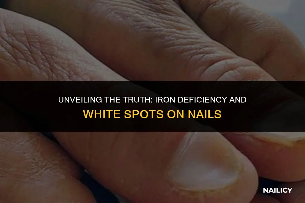 can iron deficiency cause white spots on nails
