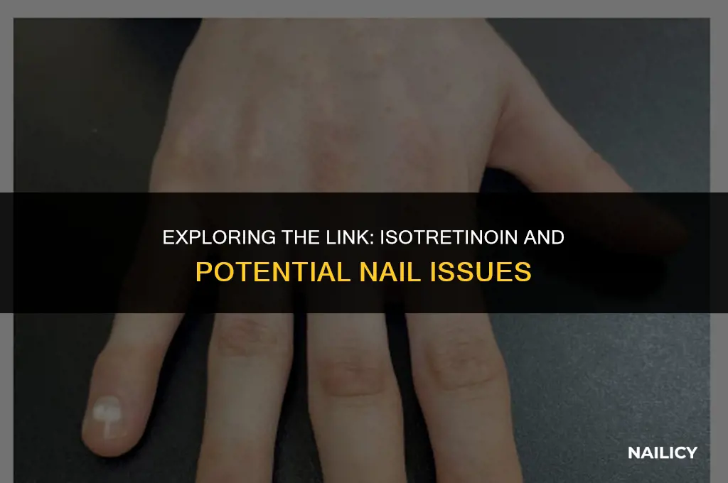 can isotretinoin cause nail problems