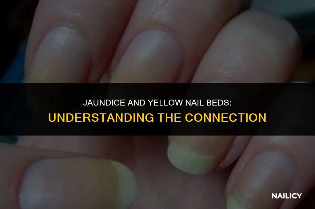 can jaundice cause the nail beds to turn yellow