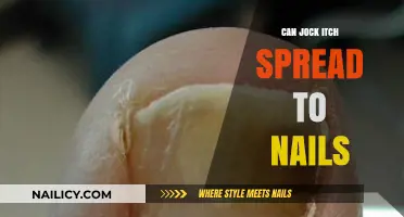 From Jock Itch to Nail Health: Understanding the Connection