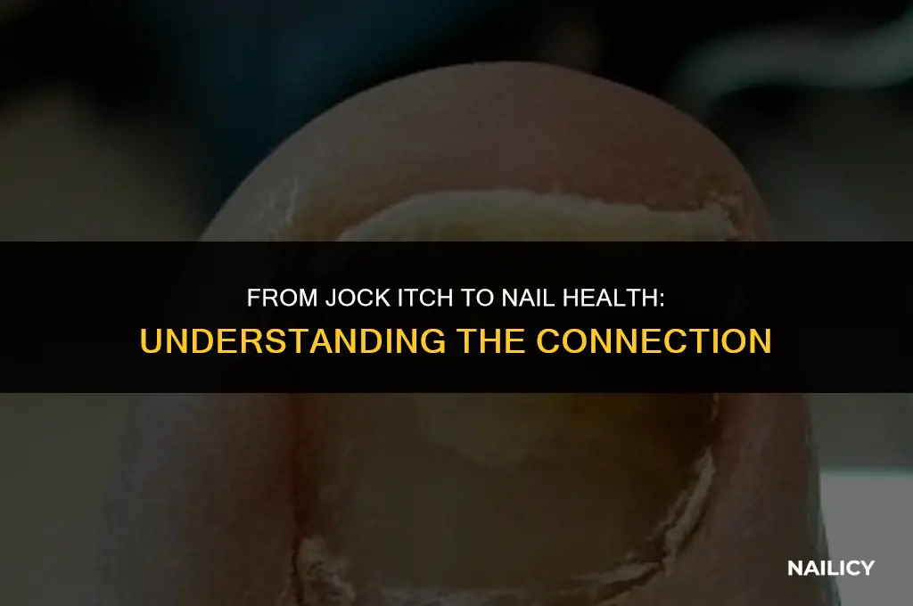can jock itch spread to nails