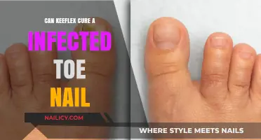 Treating Toenail Infections: Does Keflex Hold the Cure?