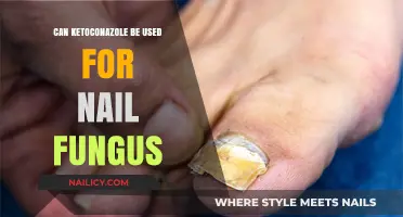 Exploring Ketoconazole: A Potential Solution for Nail Fungus