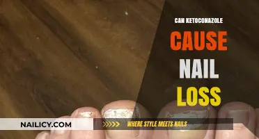 Exploring the Link: Ketoconazole and Potential Nail Loss Side Effects