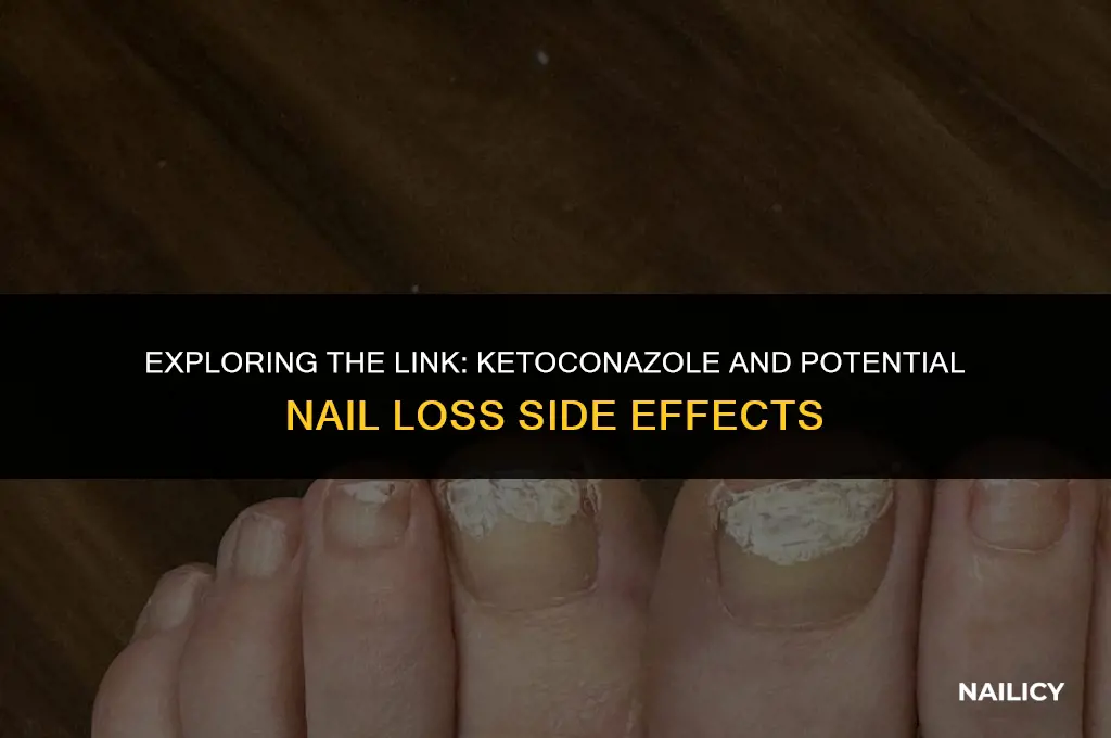 can ketoconazole cause nail loss