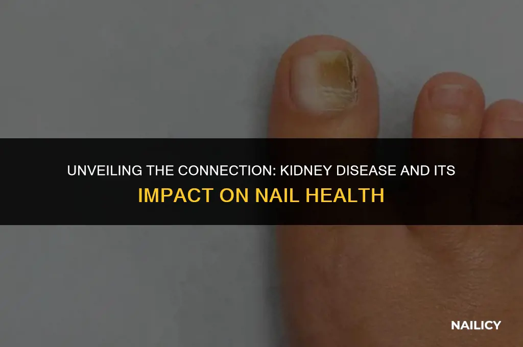 can kidney disease affect nails