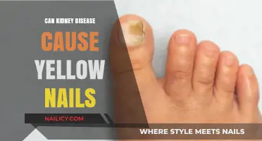 Unveiling the Connection: Kidney Disease and Yellow Nails Explained
