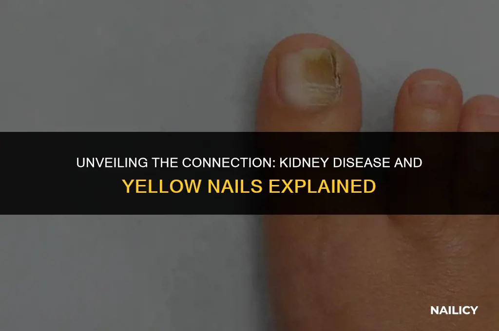 can kidney disease cause yellow nails