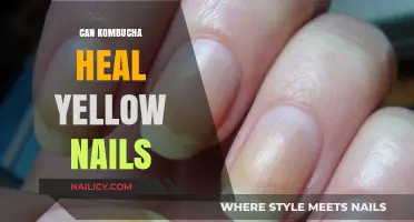 Revitalize Your Nails: The Surprising Benefits of Kombucha for Yellow Nails