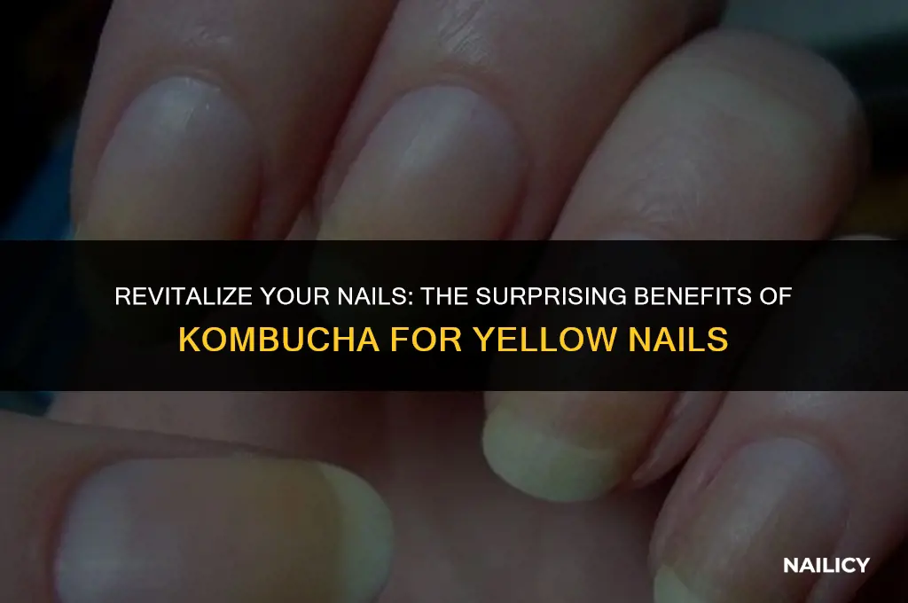 can kombucha heal yellow nails