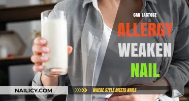 Exploring the Link: Lactose Allergy and Nail Health