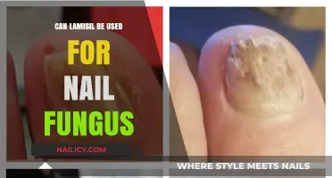 Combating Nail Fungus: Is Lamisil the Solution You Need?