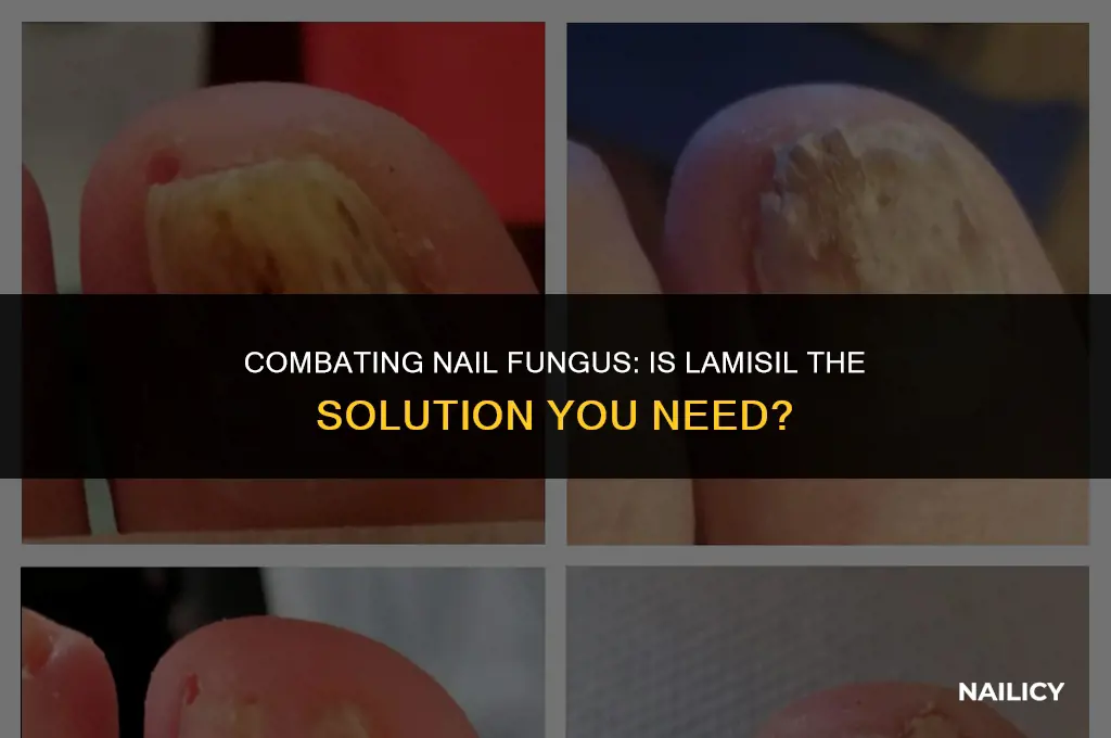 can lamisil be used for nail fungus