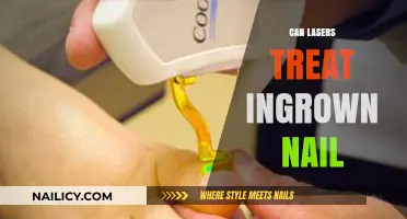 Laser Therapy for Ingrown Nails: A Modern Solution to an Age-Old Problem