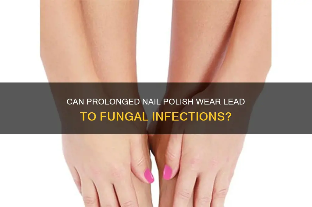 can leaving nail polish on too long cause fungus