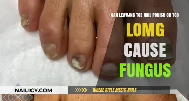 Long-Term Nail Polish Use: Fungal Risks and Toenail Health Concerns
