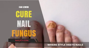 Natural Remedies for Nail Fungus: The Surprising Power of Lemon