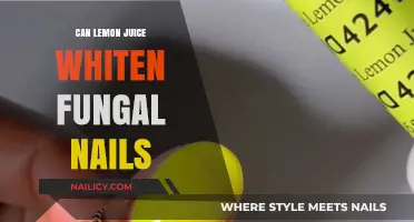 Natural Remedies: Lemon Juice's Potential for Whitening Fungal Nails