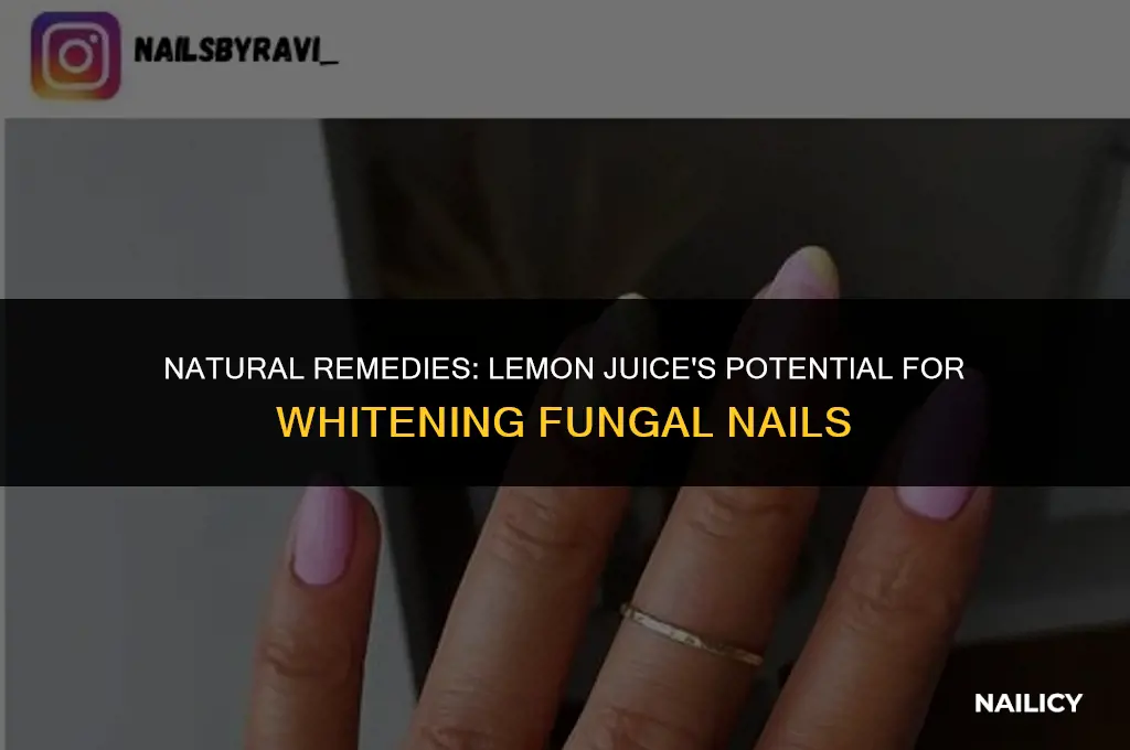 can lemon juice whiten fungal nails
