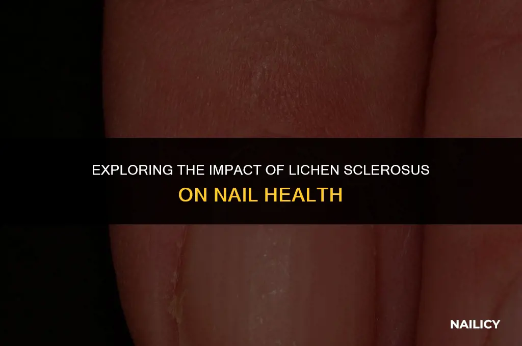 can lichen sclerosus affect nails