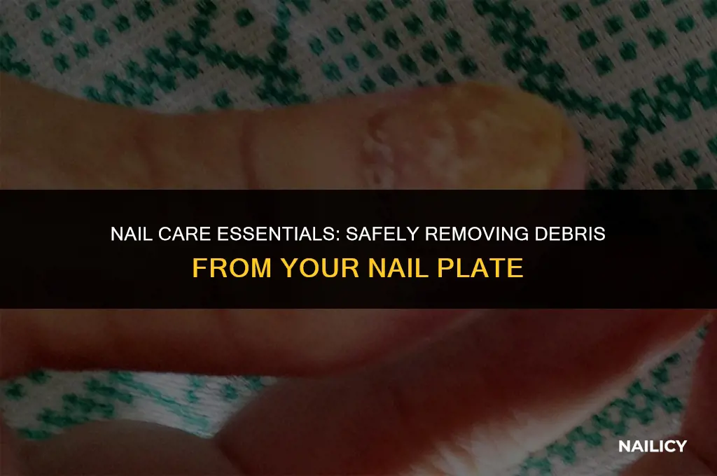 can lift small bits of debris from nail plate