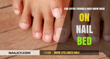 Toenail Trauma: The Surprising Truth About Lifted Toenails and Regrowth