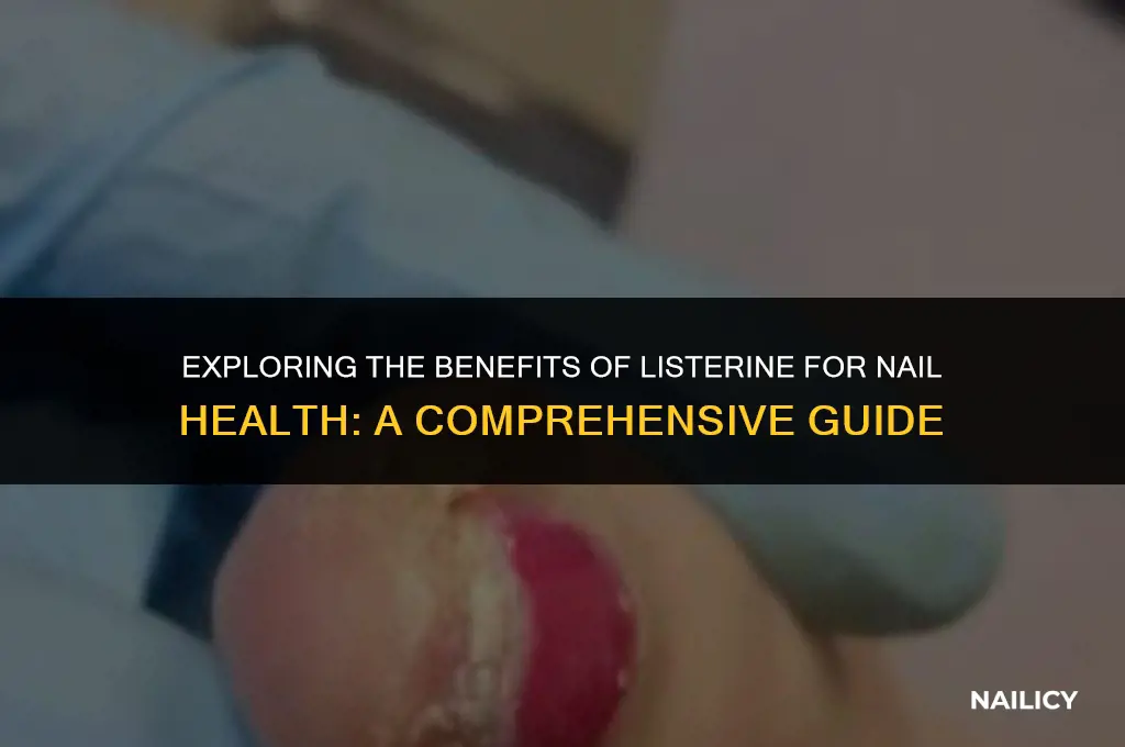can listerine help my nails