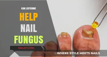 Exploring the Benefits of Listerine for Nail Fungus Treatment