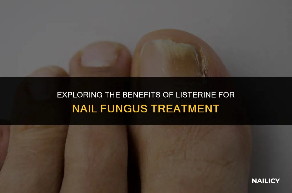 can listerine help nail fungus